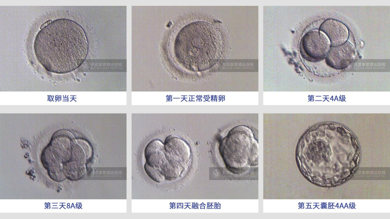 175363385206678531.1.png 1.1.png